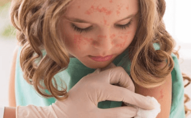 베트남 홍역 유행 예방접종