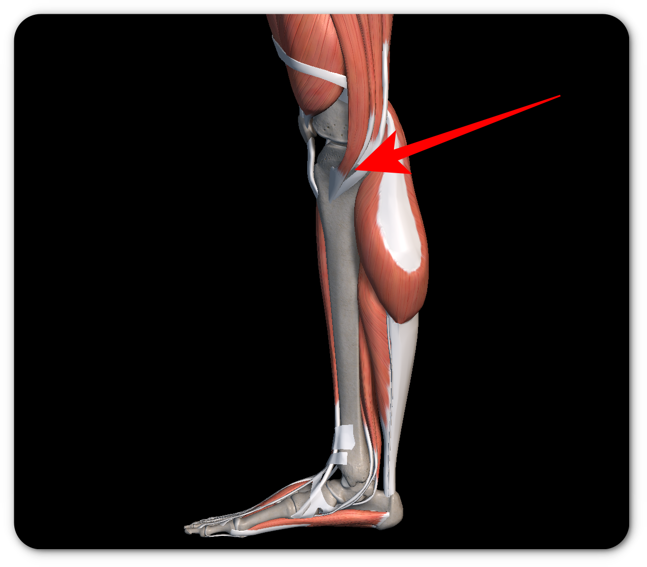 무릎 통증 치료법