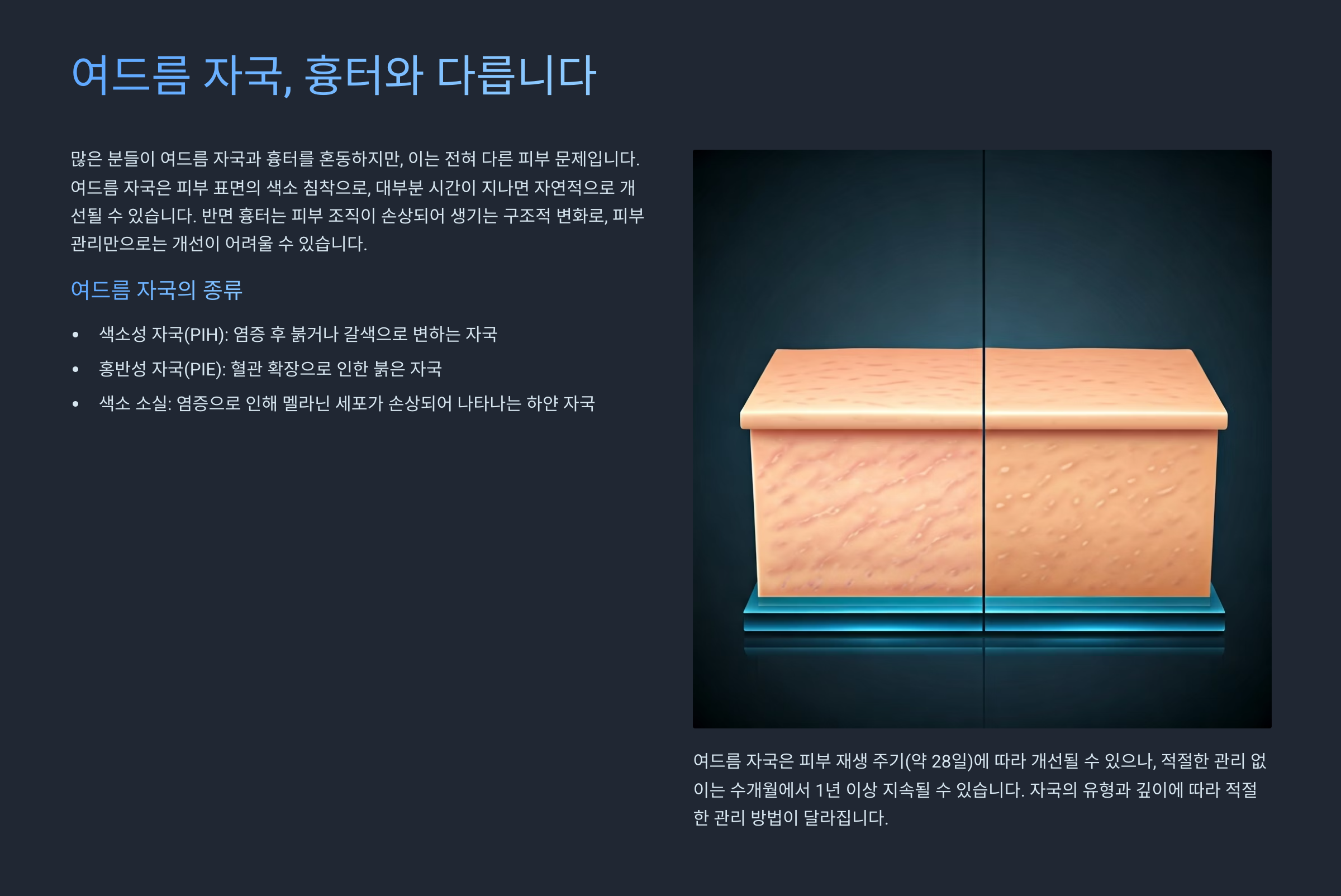 여드름 자국 개선에 필요한 성분은?