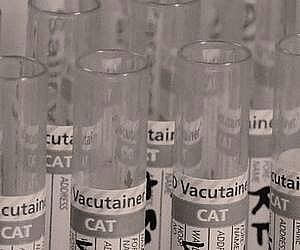 호모시스테인 검사 결과