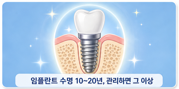1 임플란트 수명, 실제로 얼마나 될까