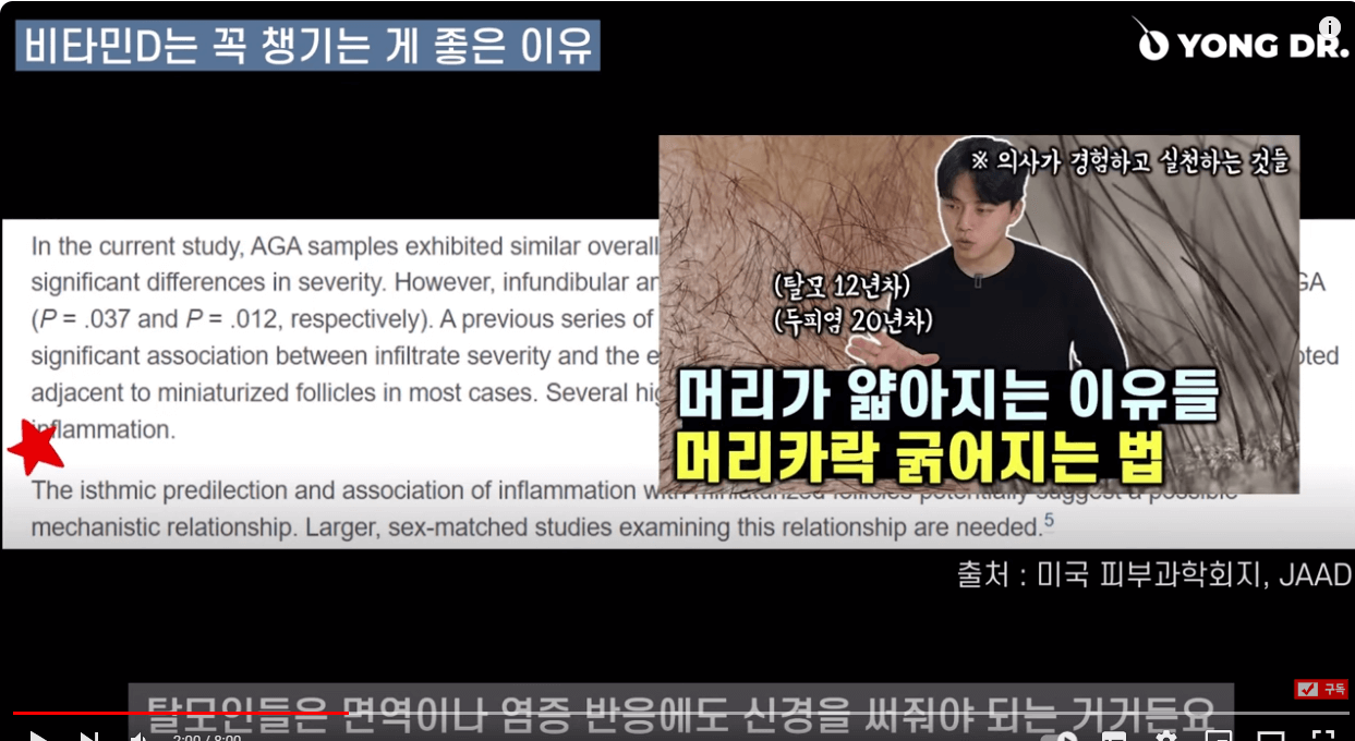 탈모에 