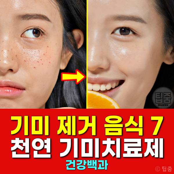 기미 제거 음식 천연 기미치료제 식품