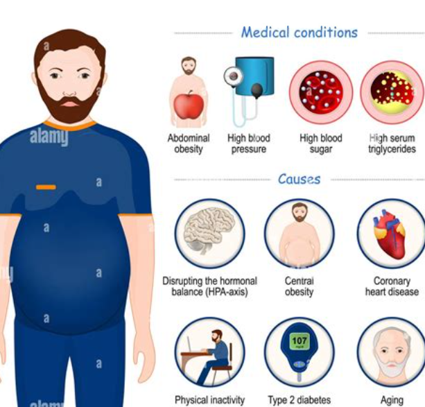 대사 증후군 이란