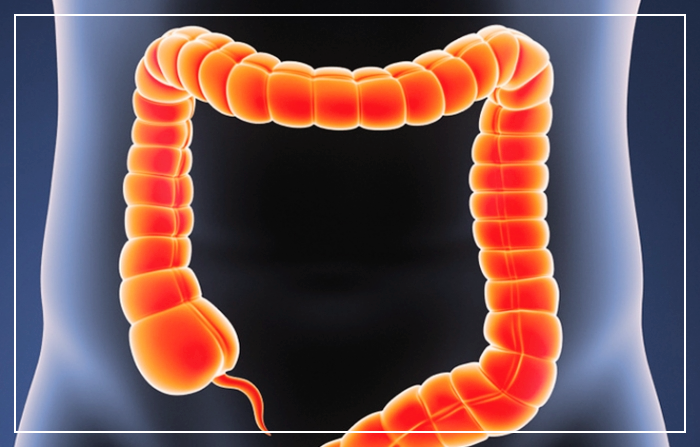 치커리-효능-장건강