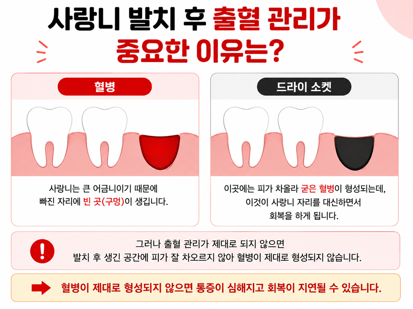사랑니 발치후 관리의 중요성