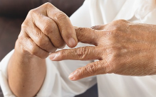 류마티스 관절염