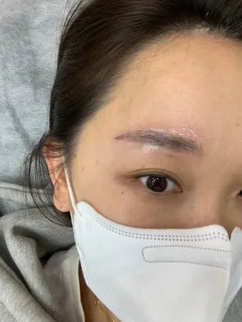 눈썹 문신 제거 방법 꿀팁_8