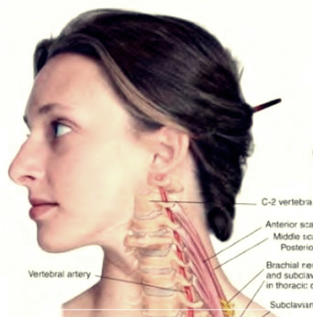 사각근이 아플 때, 당신이 알아야 할 모든 것