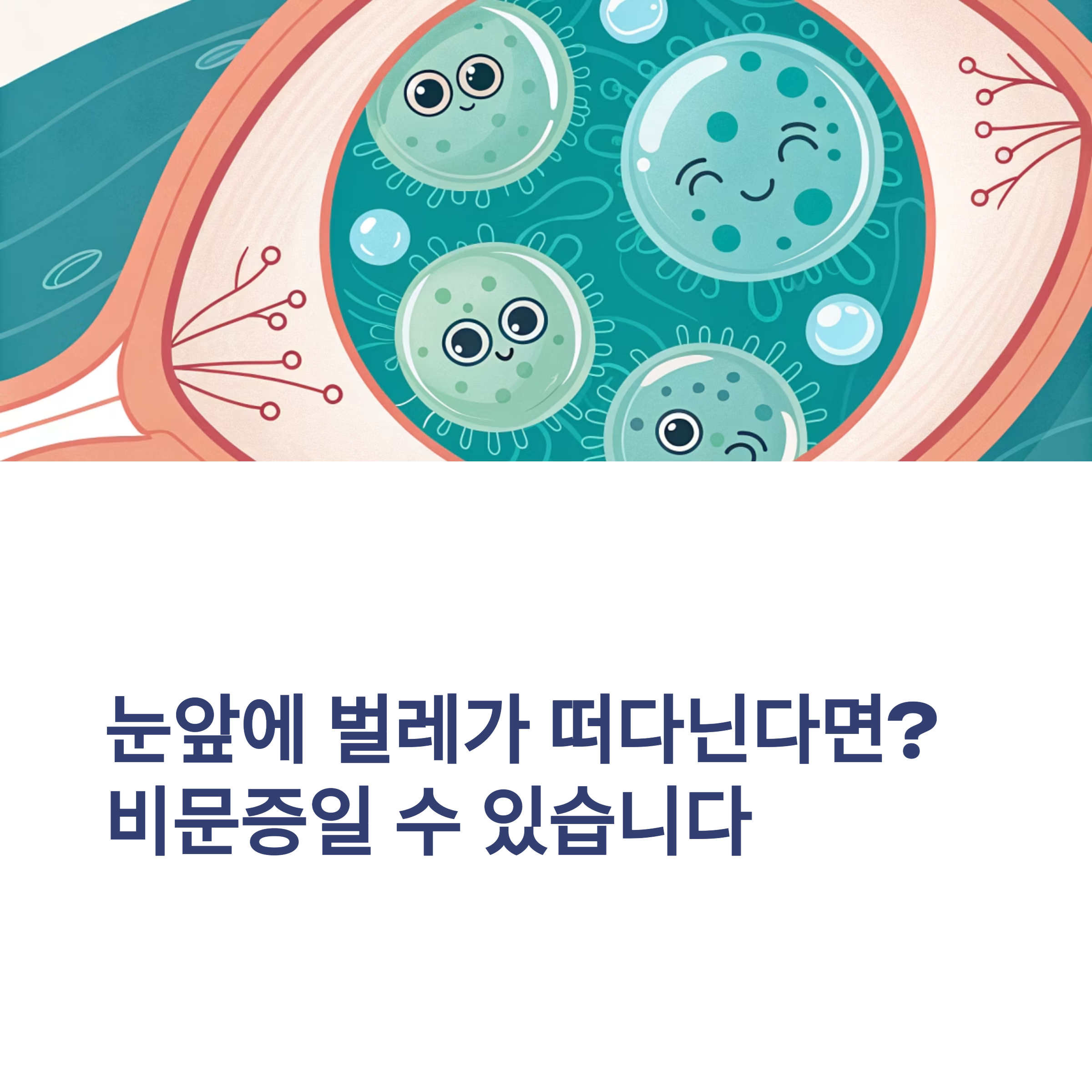 눈앞에 벌레가 떠다닌다면? 비문증일 수 있습니다
