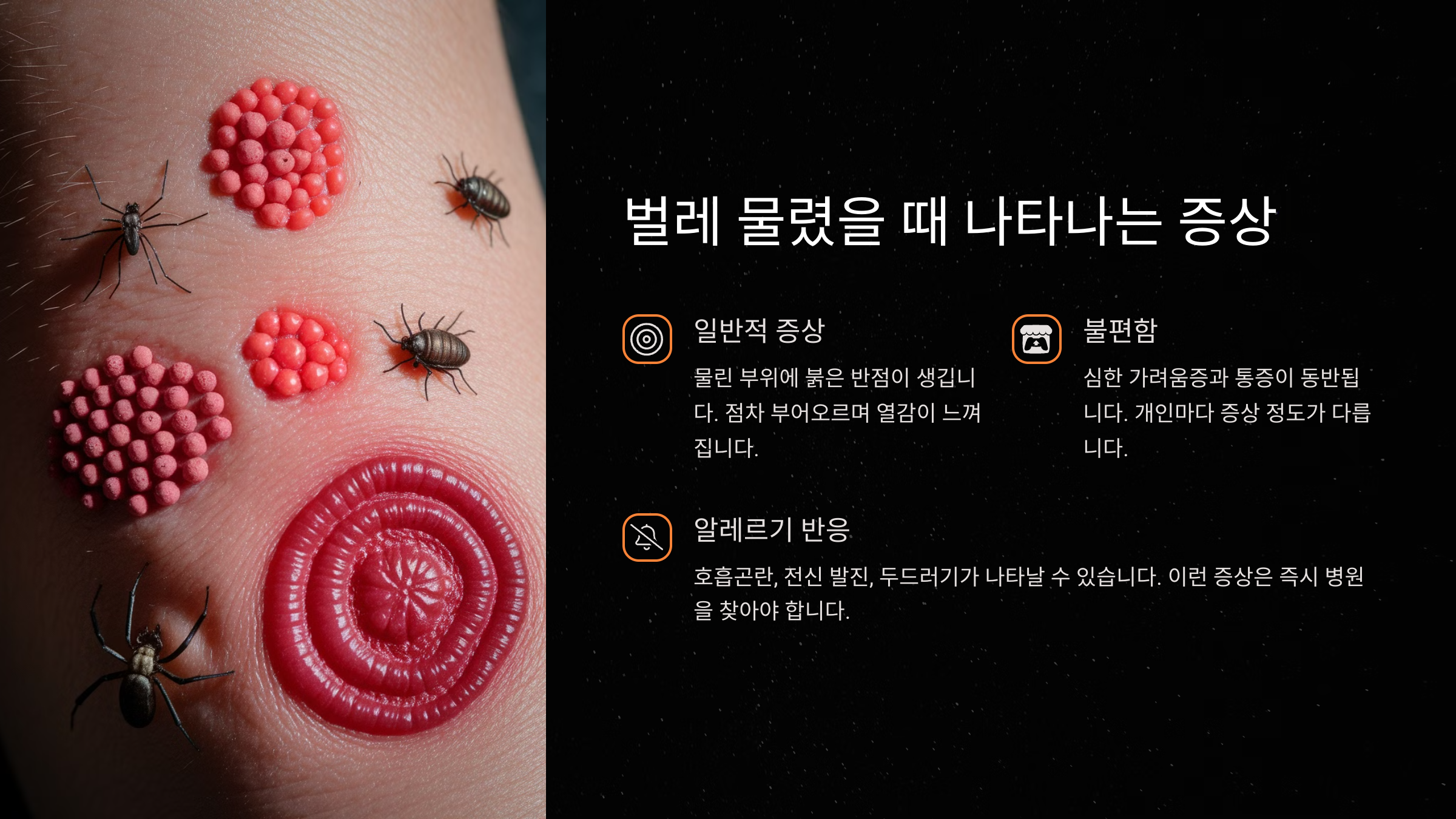 벌레 물렸을 때 나타나는 증상