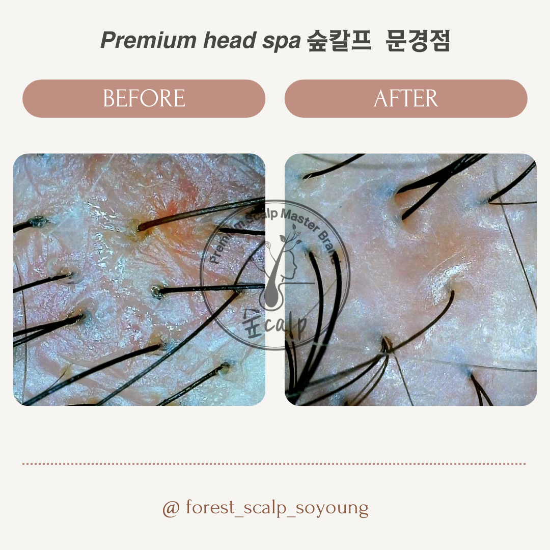 숲칼프 문경점