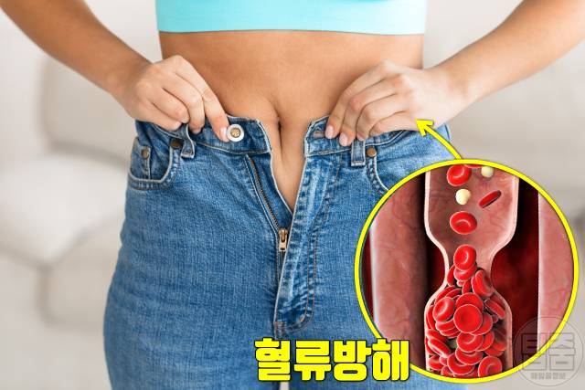 종아리 혈관 튀어나옴 하지정맥류 증상 예방