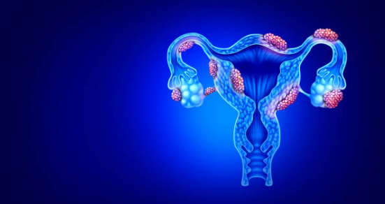 자궁근종 증상, 수술후 회복기간, 크기별 치료 총정리 (2024ver)