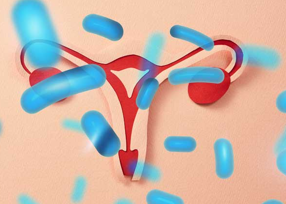 질 가려움증 원인 및 해결방법