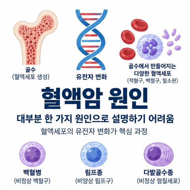 혈액암 원인과 골수 혈액세포 림프구 형질세포의 유전자 변화를 보여주는 교육용 이미지
