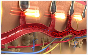 헤어빔사용후기4