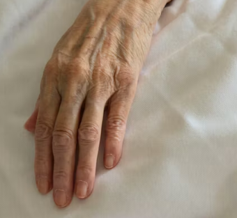 수족냉증 영양제