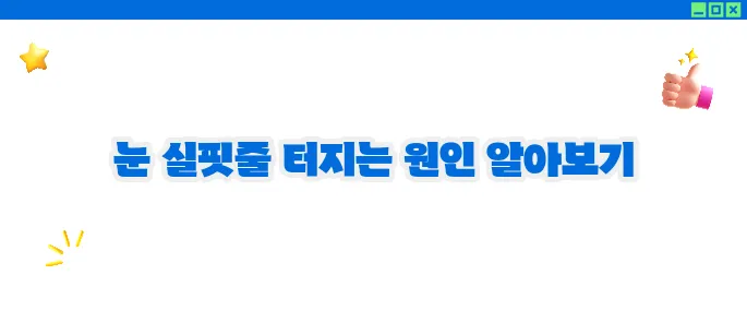눈 실핏줄이 터지는 이유 총정리 (+예방방법)