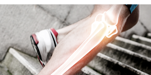 무릎 통증, 50대 이상 64%가 겪는 이유는?