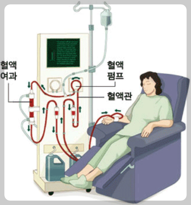 신장 투석