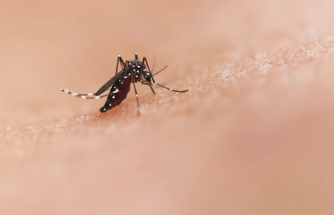 모기 봉와직염 원인