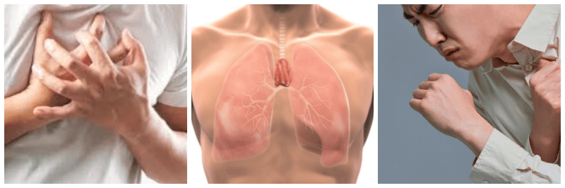 흉통, 흉선, 기침 사진