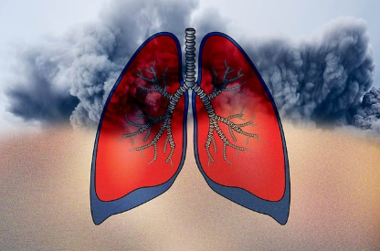 우리 곁을 위협하는 공포, 미세먼지의 원인과 해결방안