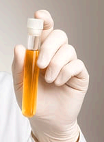 소변 색깔로 보는 건강