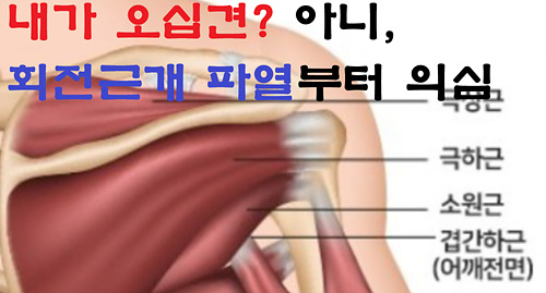 회전근개_파열