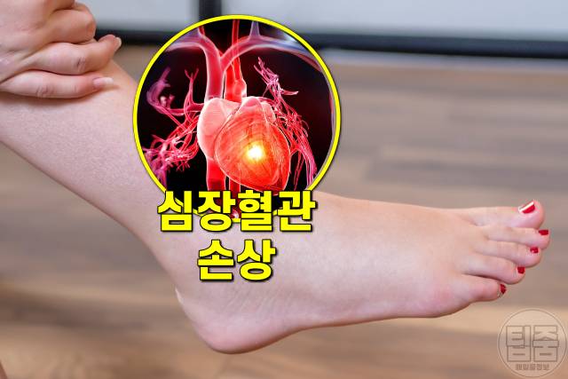 손발이 찬 이유,손발이 찬 체질,수족냉증,심장