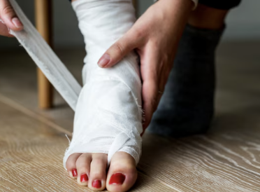 발이 붓는 이유 31