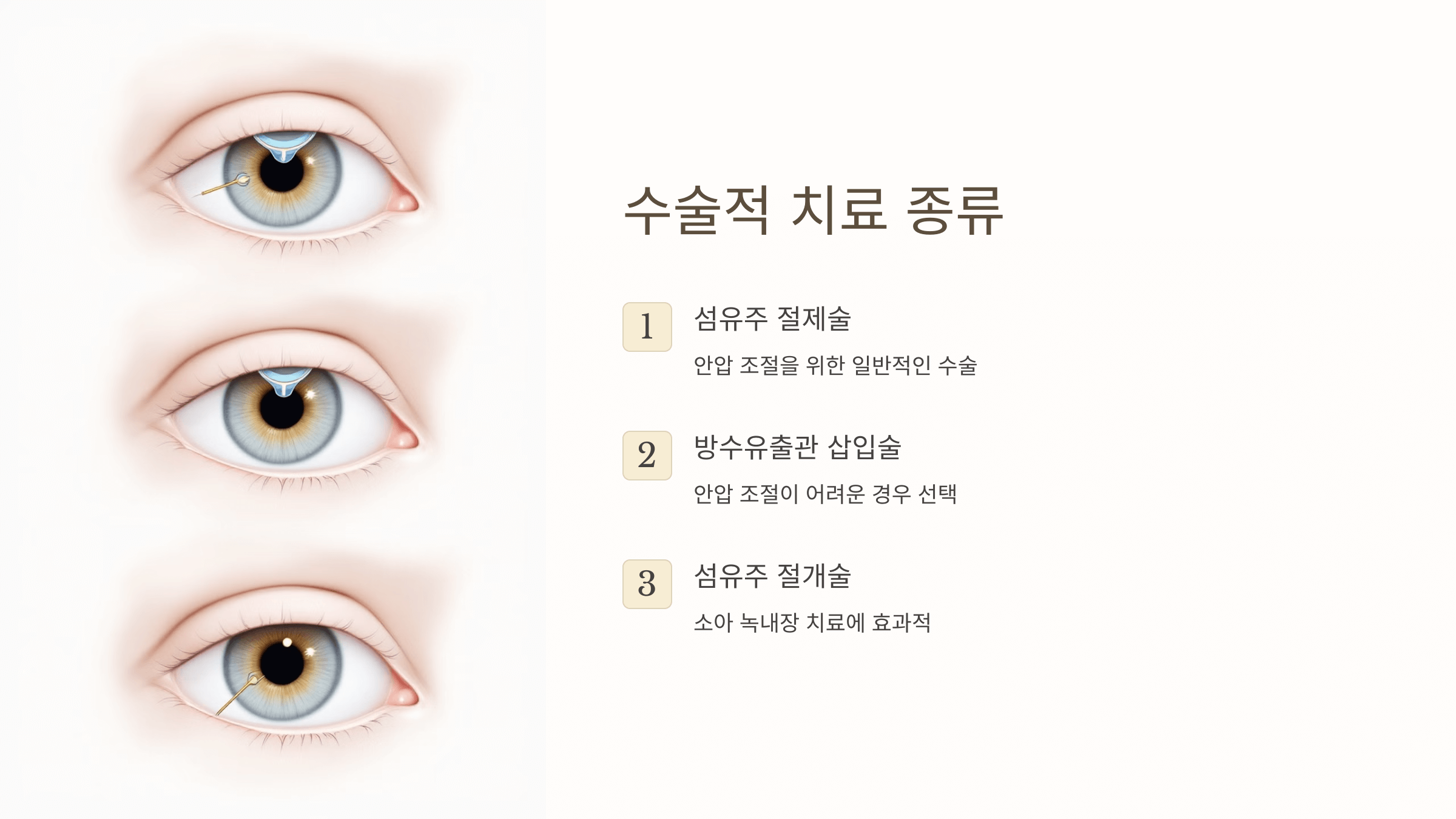 녹내장과 관련된 사진입니다.