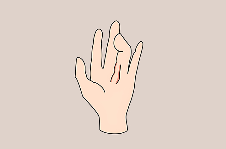 경직