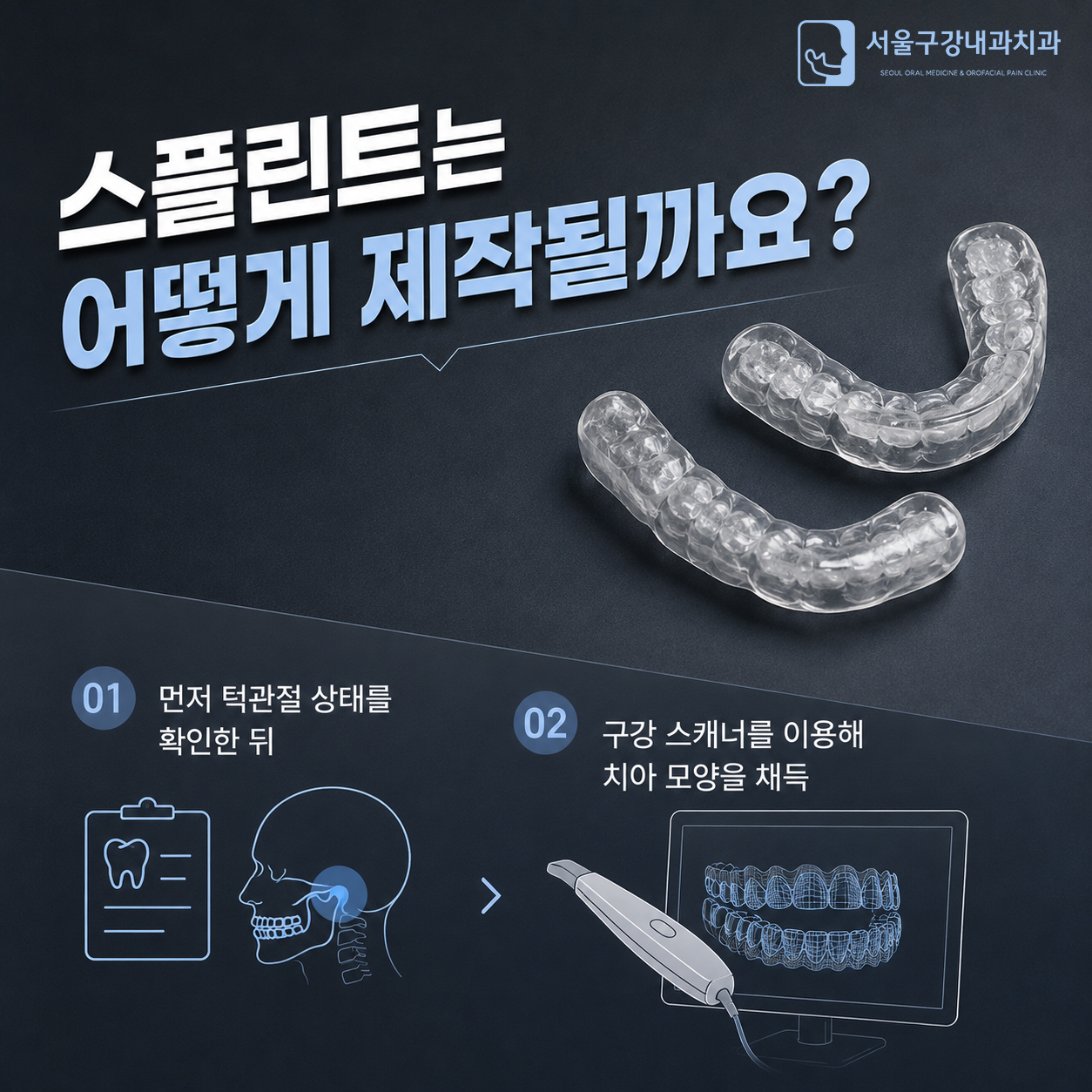 구강 스캐너를 이용한 턱관절 스플린트 제작 과정 안내