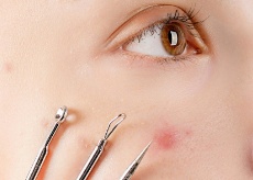 노스카나겔 가격, 사용법, 효과, 파는곳