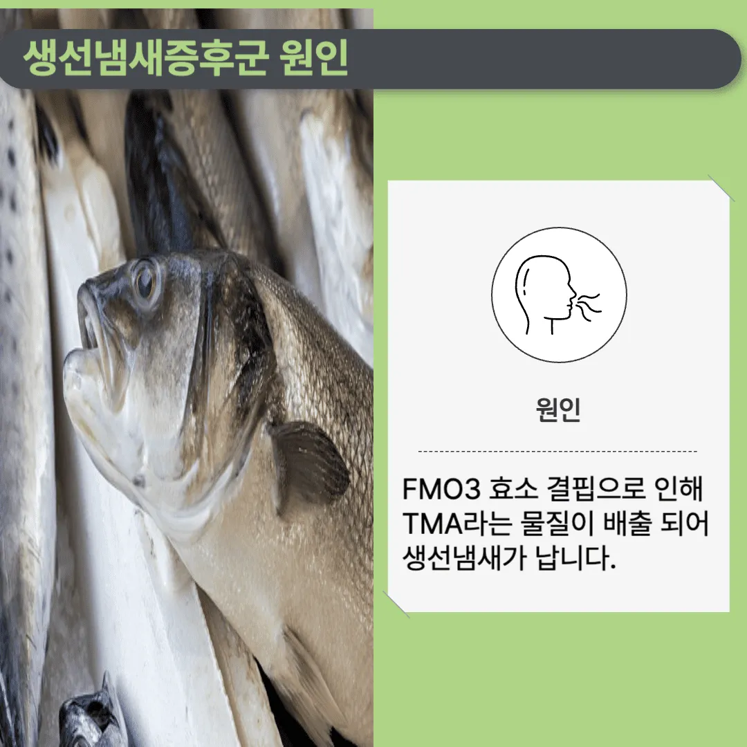 생선냄새증후군이란?