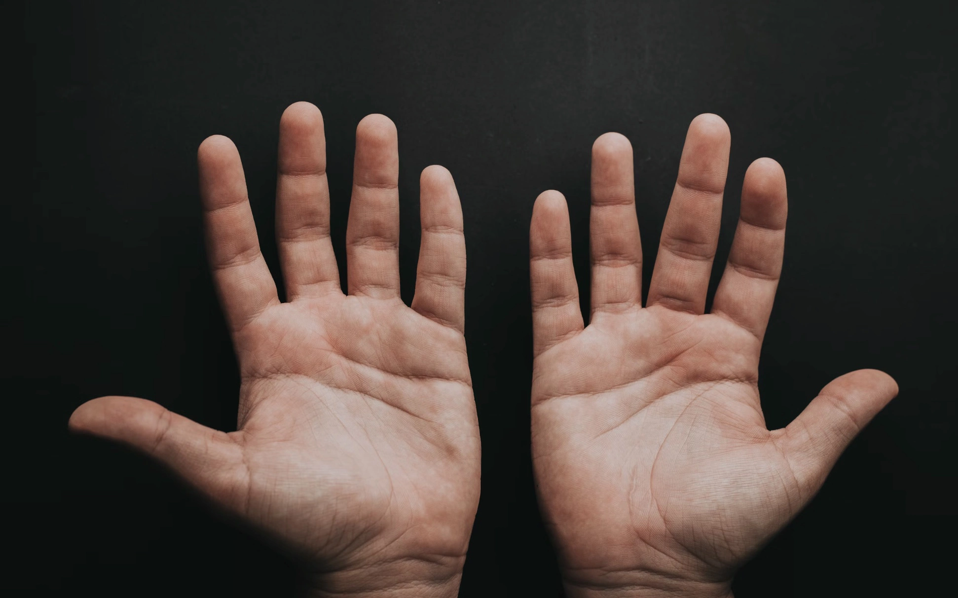 손가락 퇴행성관절염