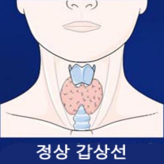갑상선 기능 저하증 증상