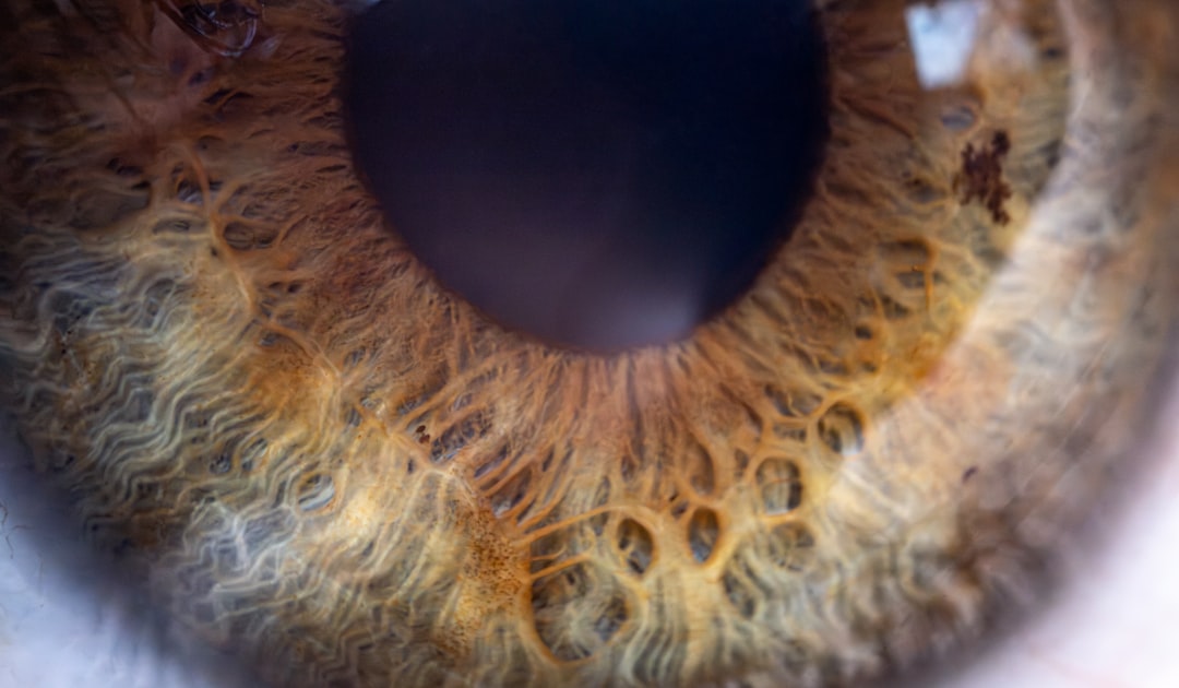 Cataract