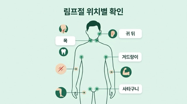 위치별 임파선염 원인 지도