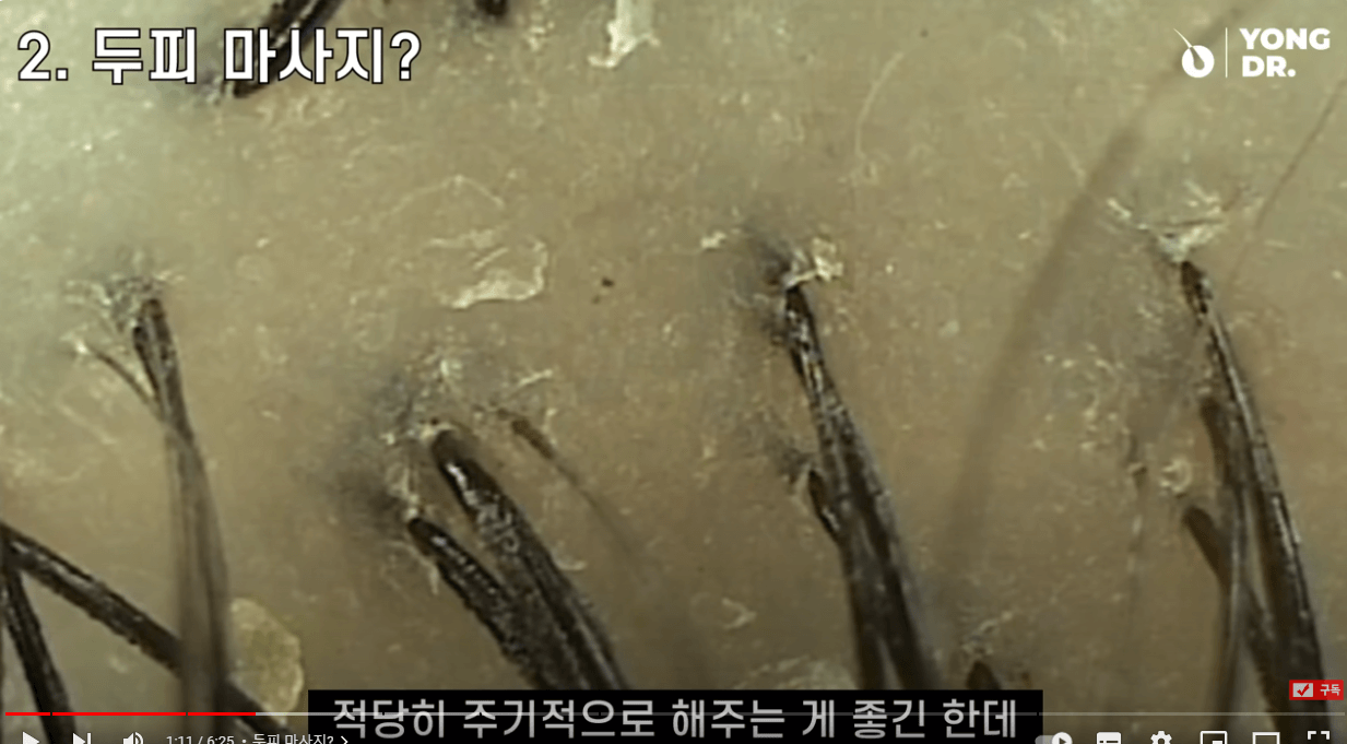 머리 감을 때 절대 하지 말아야 할 행동(9가지)-의사강력추천! ##탈모 #지루성두피염 #머리감기습관 #지루성피부염 #탈모예방 #탈모치료 #두피여드름 #두피뾰루지 #두피건선 #두피가려움 #비듬 #두피각질 #지루성두피염관리 #두피관리 #탈모관리#탈모 #지루성두피염 #머리감기습관 #지루성피부염 #탈모예방 #탈모치료 #두피여드름 #두피뾰루지 #두피건선 #두피가려움 #비듬 #두피각질 #지루성두피염관리 #두피관리 #탈모관리 태그 삭제#탈모탈모 태그 삭제#지루성두피염지루성두피염 태그 삭제#탈모 머리감는 법탈모 머리감는 법 태그 삭제#탈모 머리감기탈모 머리감기 태그 삭제