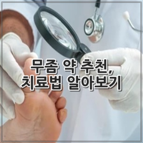 무좀 약 추천, 치료법 알아보기