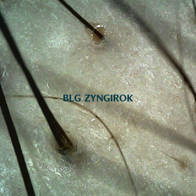 피나모아 복용 20주차 - 정수리와 이마 사이 두피 모습이다.