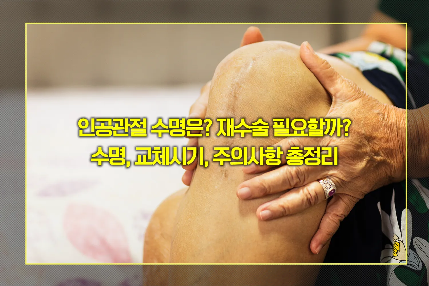 인공관절_수명_재수술_교체시기_주의사항