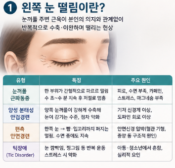 왼쪽-눈-떨림-원인-증상-치료