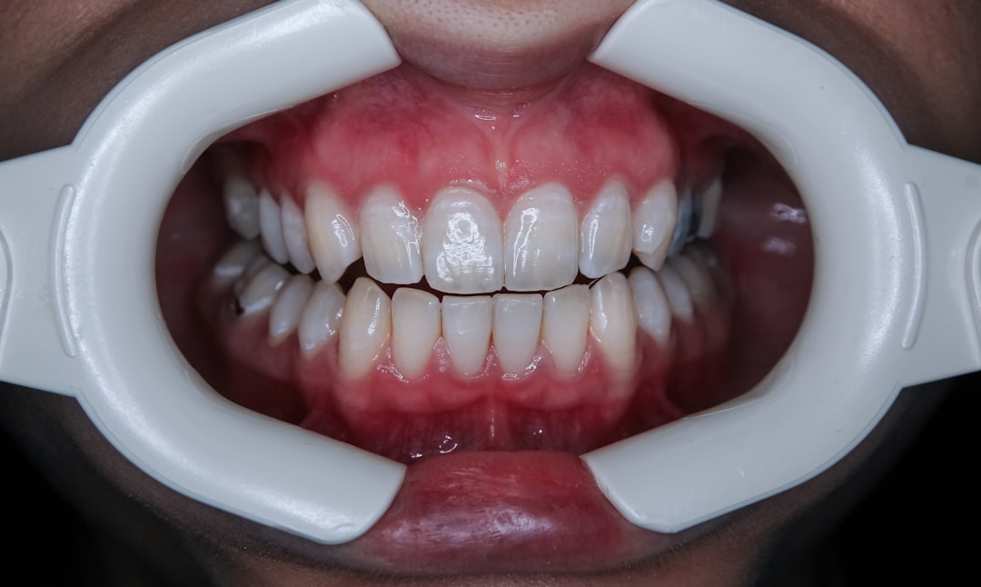 Dental insurance.