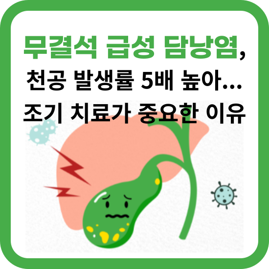 물결석-급성-담낭염