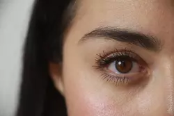 백내장 수술후 주의사항