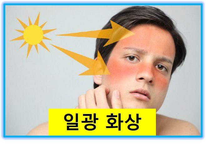 썬크림